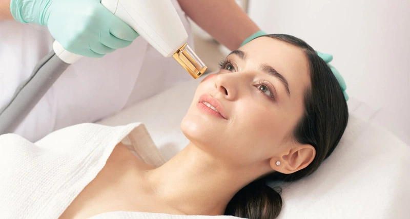 Cách trị mụn bọc bằng phương pháp laser