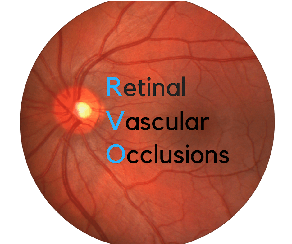 Retinal Vein Occlusion (RVO) Market.png