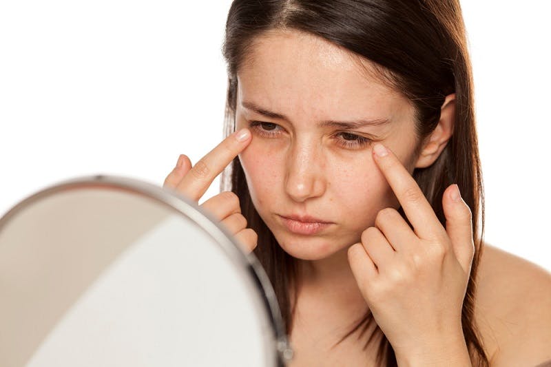dark circles under eyes.jpg