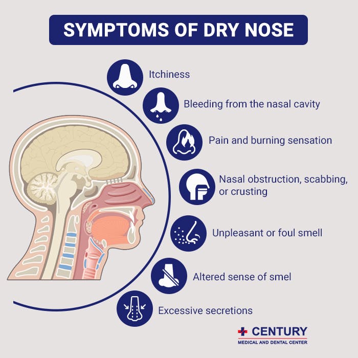 Symptoms of Dry Nose.jpg