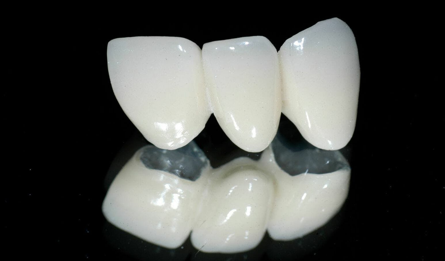răng sứ ceramill
