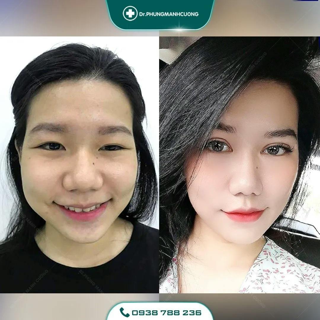 cat-mi-co-lam-mat-to-ra-khong-1.webp