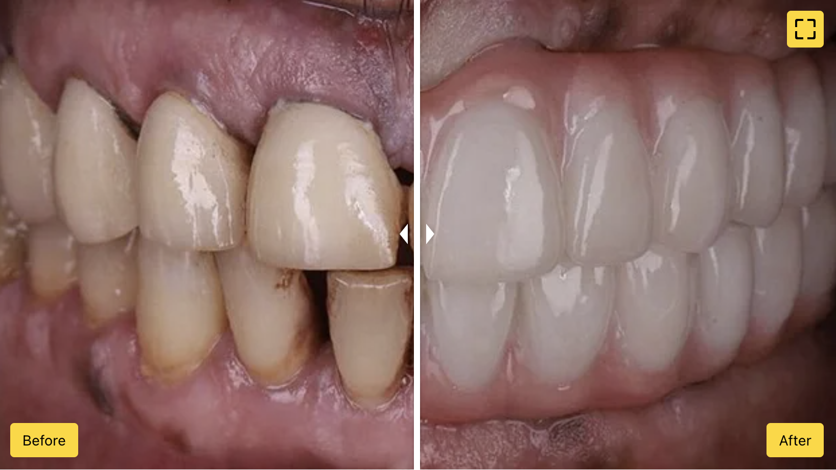 CleanShot 2024-10-16 at 11.09.39@2x.png