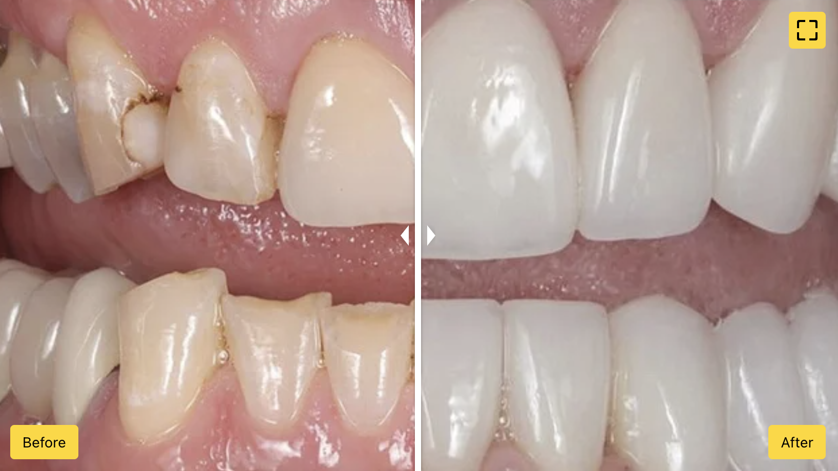 CleanShot 2024-10-16 at 11.09.58@2x.png